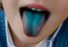 blue tongue