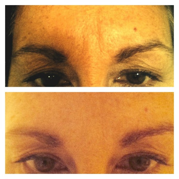 beforeafter brow
