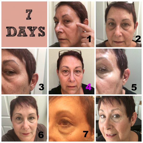 7 day wrinkle repair