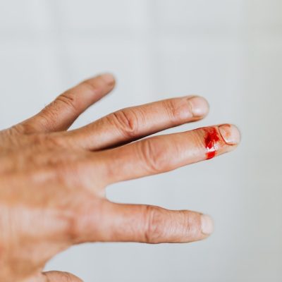 8 Ways To Improve Wound Healing