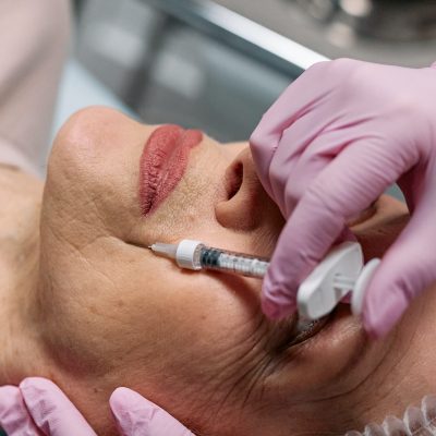 Botox: Is There Really an Age Limit for Starting Treatment